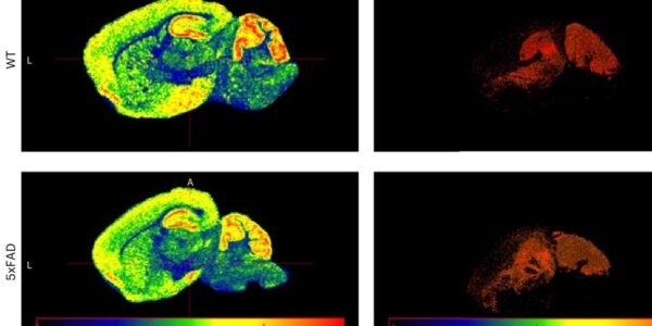 AI Tool Creates Detailed 3D Map of Mouse Brain Metabolism - TechnoMag